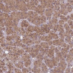 TBC1D4 Antibody, Novus Biologicals:Antibodies:Primary Antibodies